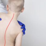 Guide to Sugar Intake After Weight Loss Surgery: The Basics