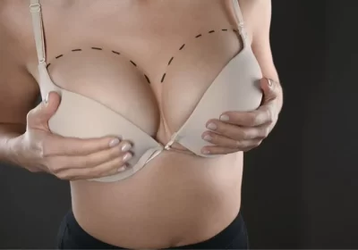 Correcting Asymmetric Breasts: A Comprehensive Guide to Treatment Options